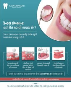 Painless Dental Implant in Ahmedabad