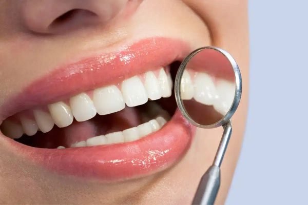 10-Steps-to-Keep-Your-Teeth-Healthy